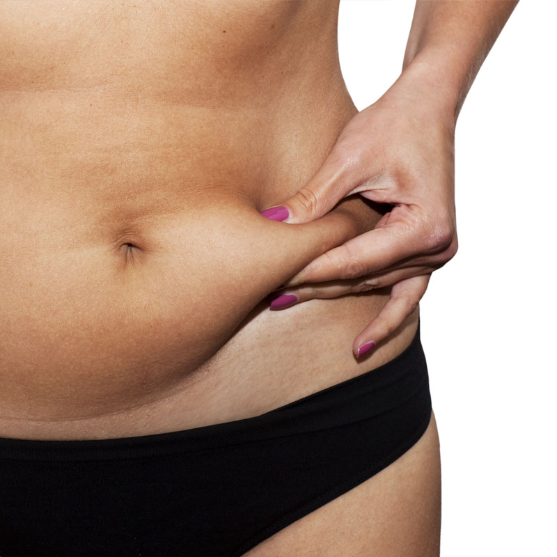 bb-trattamenti-corpo-adiposita-localizzate